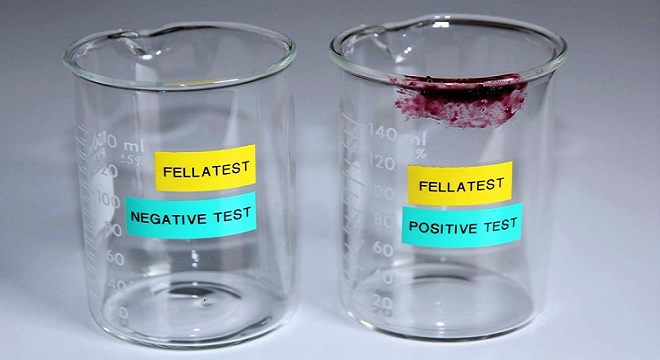 - Le-test-salivaire-FELLATEST-permet-désormais-de-détecter-les-fellations-extraconjugales-3