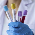 coronavirus-analyse