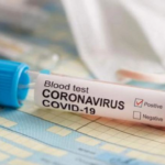 coronavirus-test-003