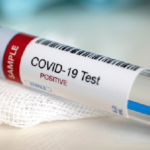 coronavirus-test-004