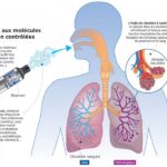 – Les cigarettes électroniques sont vraiment néfastes pour la santé